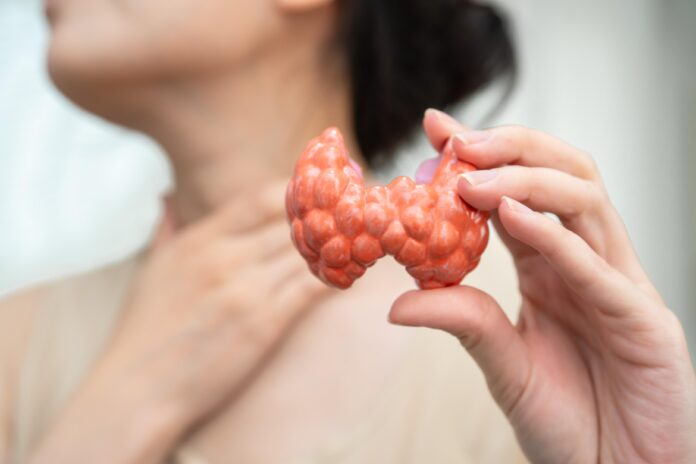 hyperthyroidism-overactive-thyroid-thyroid-lymphoma-asian-woman-with-thyroid-gland-human-anatomy-model (1)